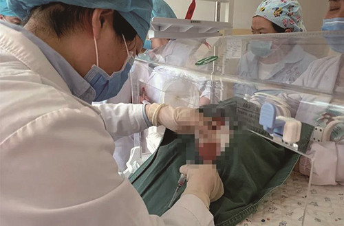 区医院对口帮扶宁夏隆德县人民医院顺利完成首例新生儿腰椎穿刺术